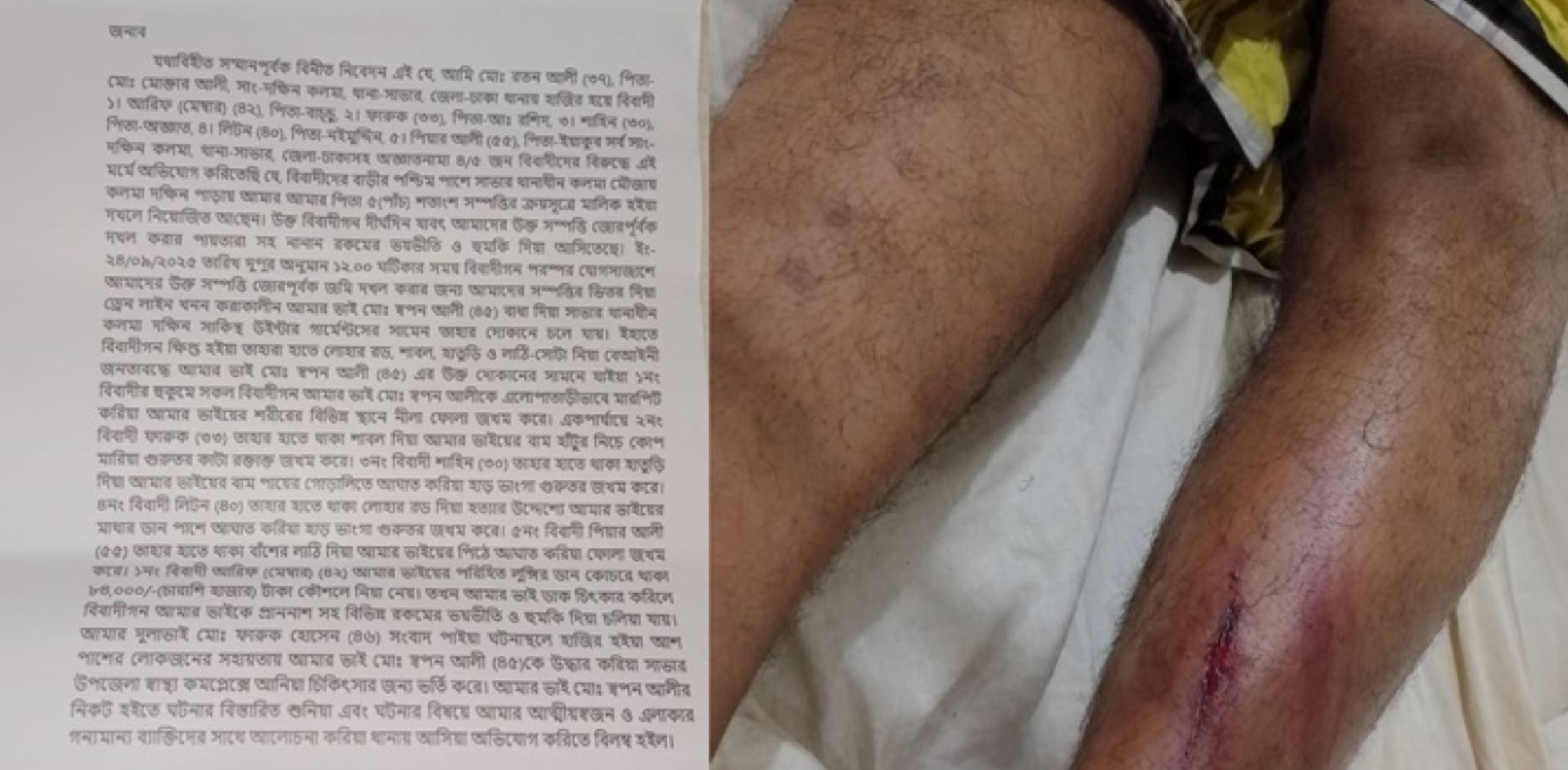 সাভারে ব্যক্তি মালিকানাধীন জমিতে জোরপূর্বক ড্রেন নির্মাণে বাধা: ব্যবসায়ীকে মারধরের অভিযোগ